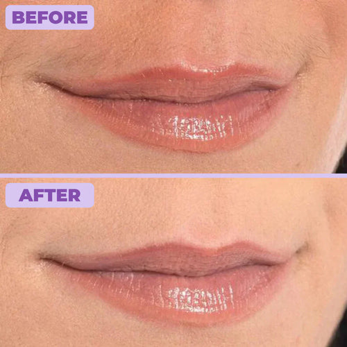 Facial Hair Removal Cream | 1+1 FREE