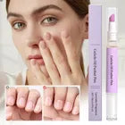 Cuticle Pusher Pen - Precision Cuticle Pusher | Remover Pen